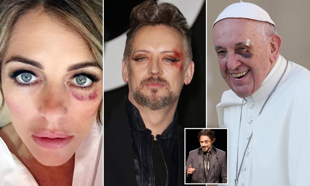 The black eye on the right eye is a depiction of the all-seeing eye