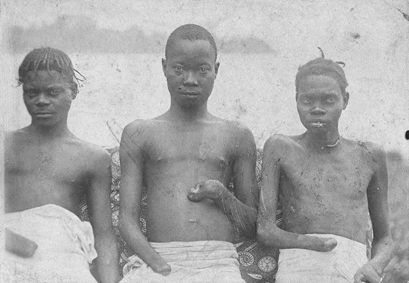 Victims of Leopold's brutal reign in the Congo